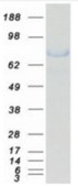 SDS-PAGE (XRCC1-778HFL).jpg